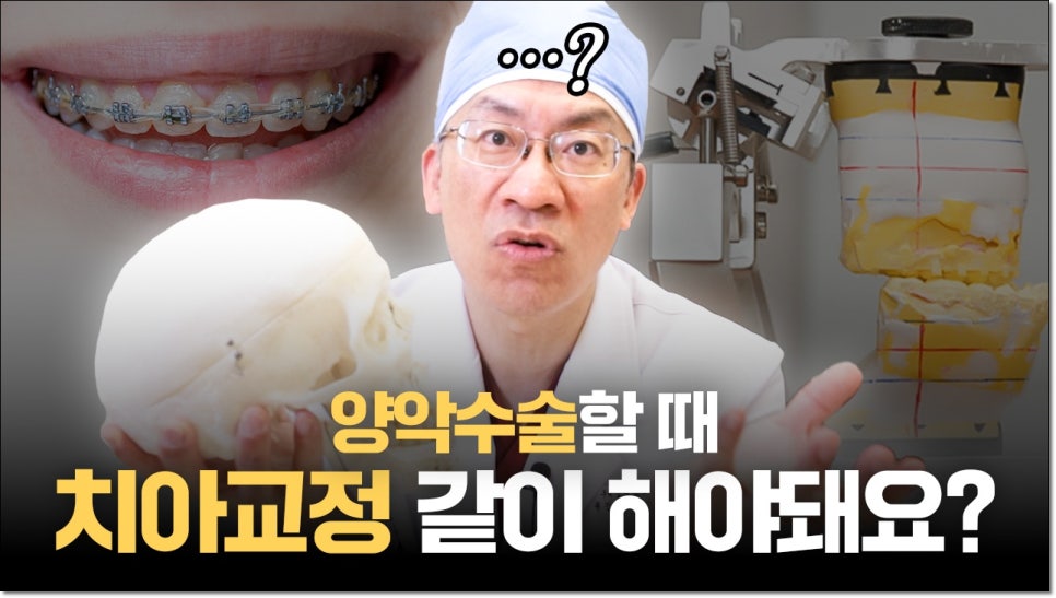 양악시술 치아교정이 필요하나요? 관련 이미지 1