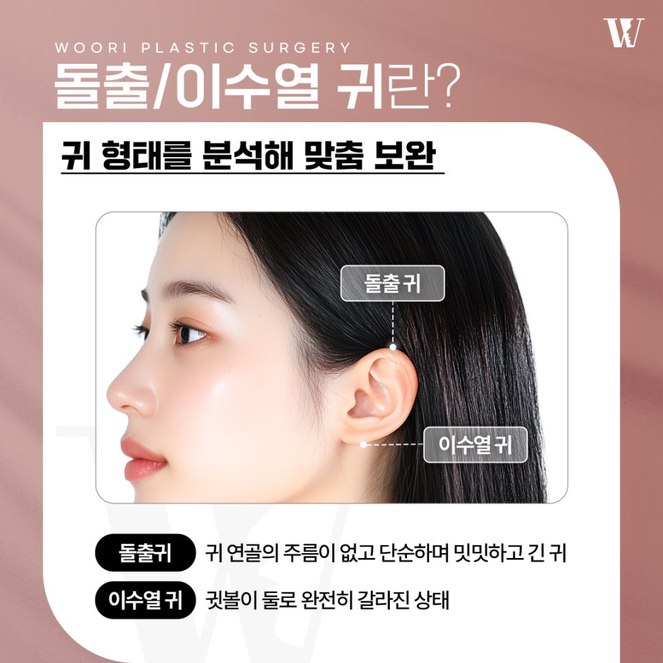 Worried It Will Look Obvious After Earlobe Surgery? image 2