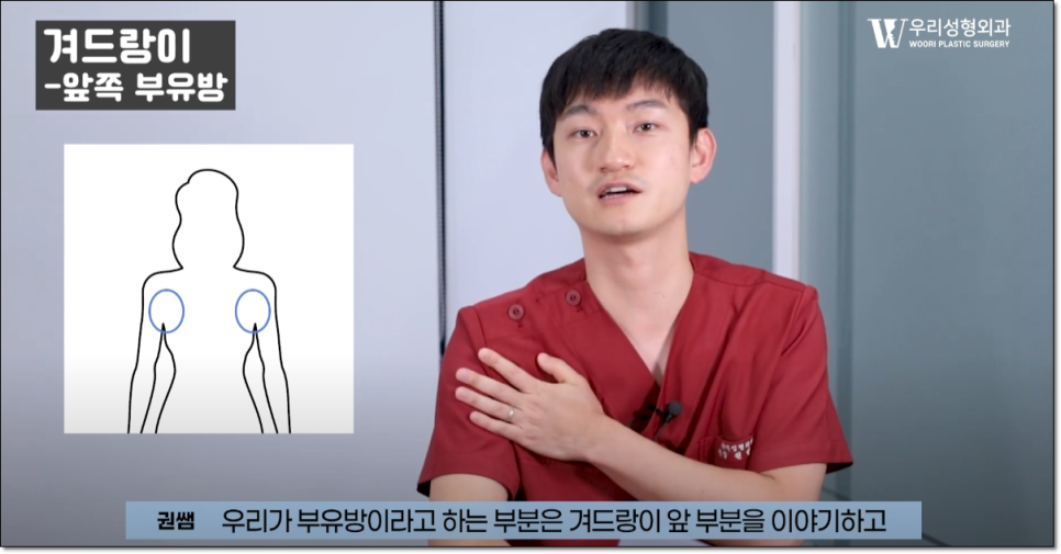 상체지방흡입 효과 한눈에 알아보기 관련 이미지 3