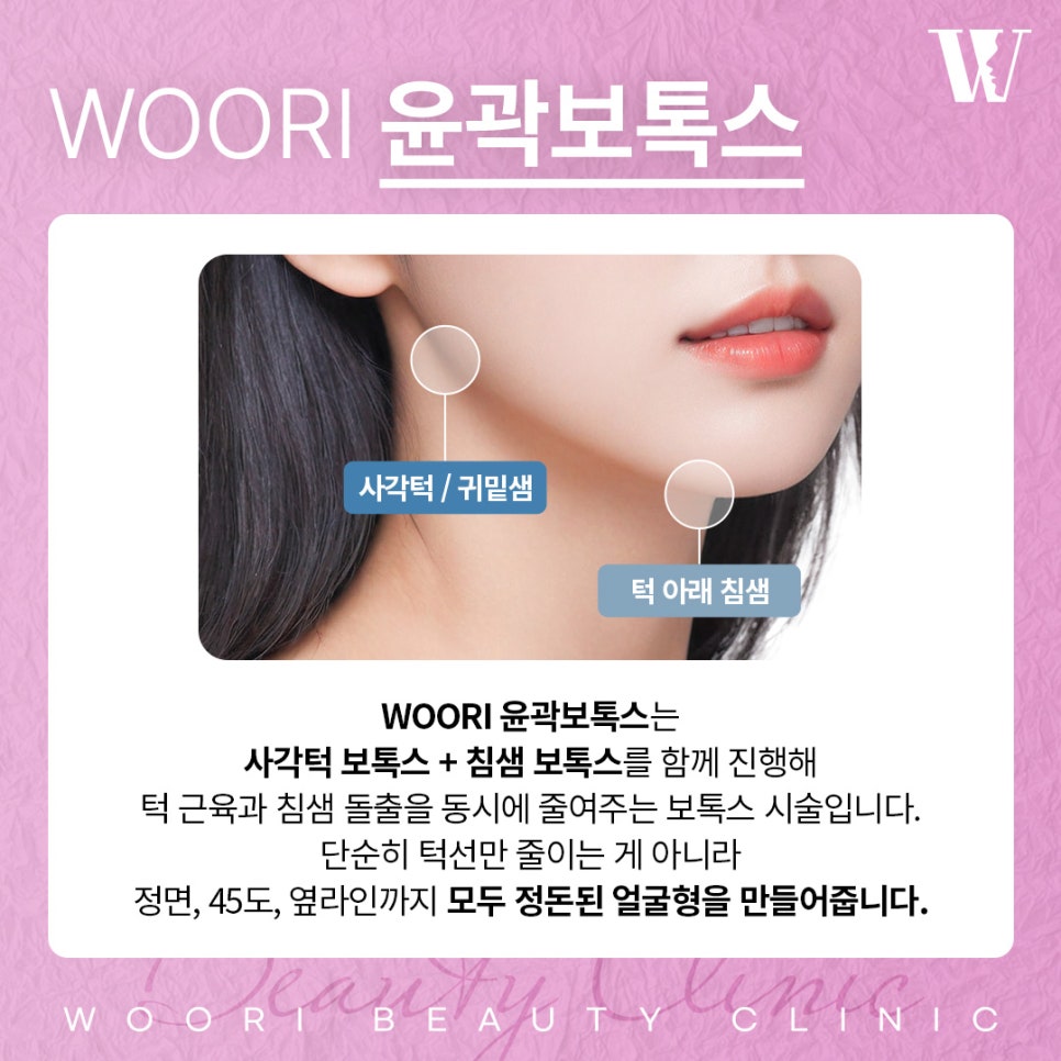 사각턱보톡스 턱선은 어떻게 달라질까 관련 이미지 2