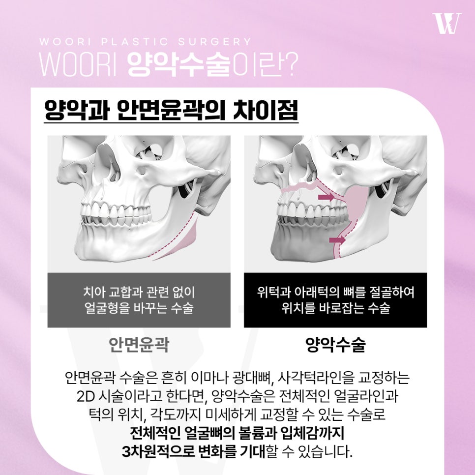 Why Facial Bone Balance Matters in Double-Jaw Surgery image 4