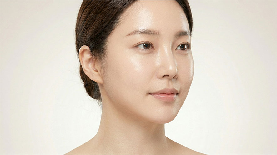 쥬베룩볼륨 자연스러운 볼륨 개선 방법은? 관련 이미지 3
