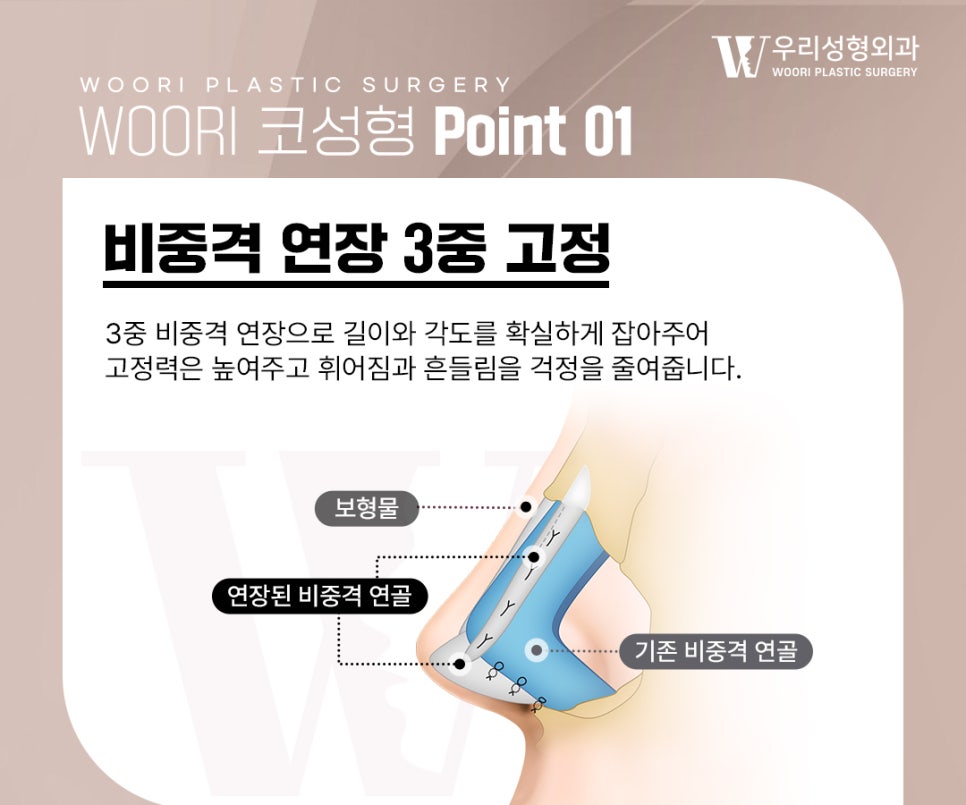 코성형 코끝의 안정감까지 생각합니다 관련 이미지 3