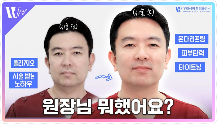 올리지오 주기 어떻게 되나요? 관련 이미지 1