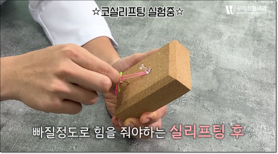 코끝성형비용 체크할 사항은? 관련 이미지 5