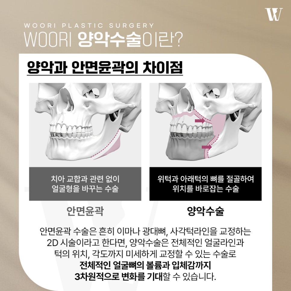 양악수술 안면윤곽으로 해결하기 어려운 골격 문제 관련 이미지 2