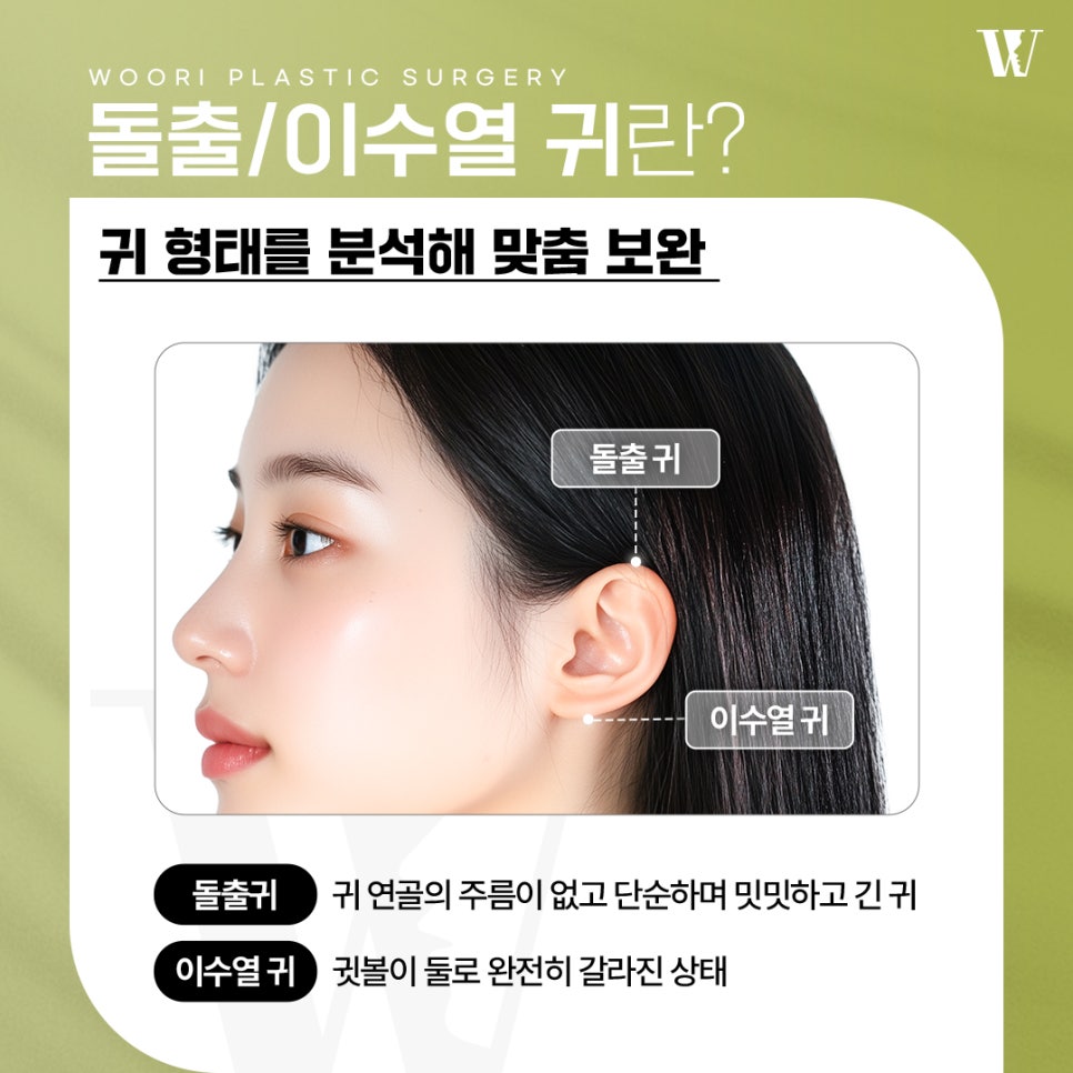 이수열수술 필요한 사람은? 관련 이미지 2