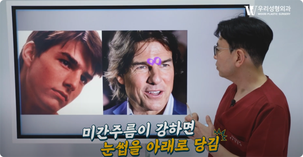 이마거상 비용 사용해야될까 관련 이미지 2