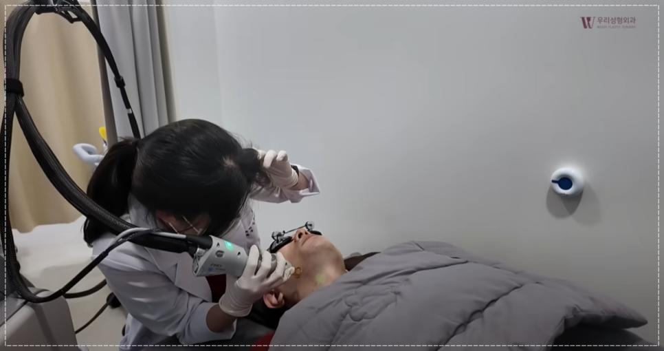 수염 레이저제모 주기 젠틀프로맥스 알아보기 관련 이미지 5