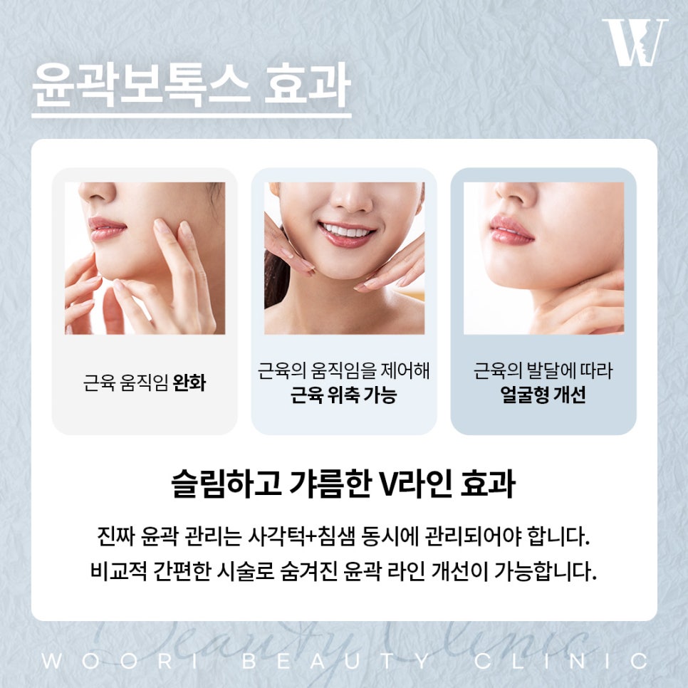 How Contour Botox Creates More Defined Facial Lines image 3