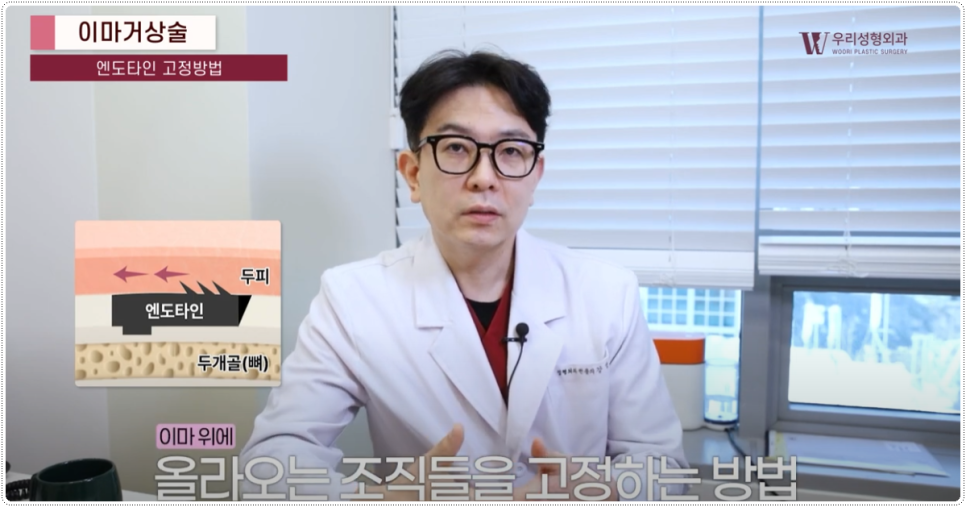 20대 이마거상술 어떤 재료를 사용해야할까? 관련 이미지 4