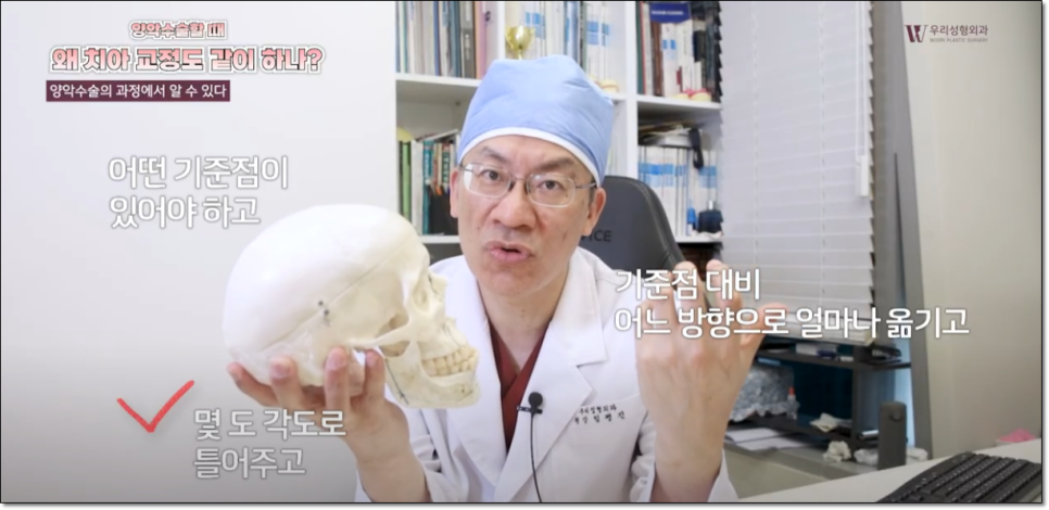 양악시술 치아교정이 필요하나요? 관련 이미지 3