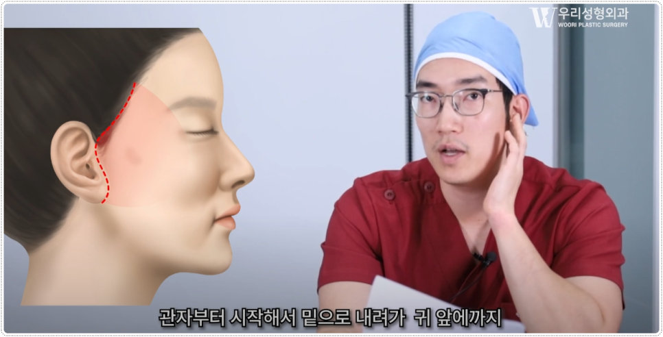 미니거상붓기 어떻게 변화될까 관련 이미지 2