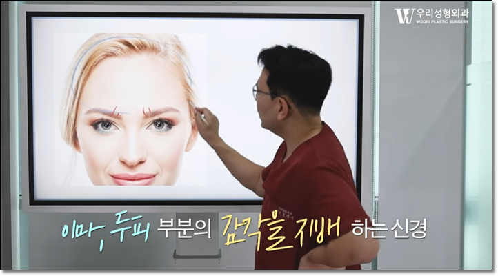 내시경이마거상 수술 방법 알아보자 관련 이미지 4
