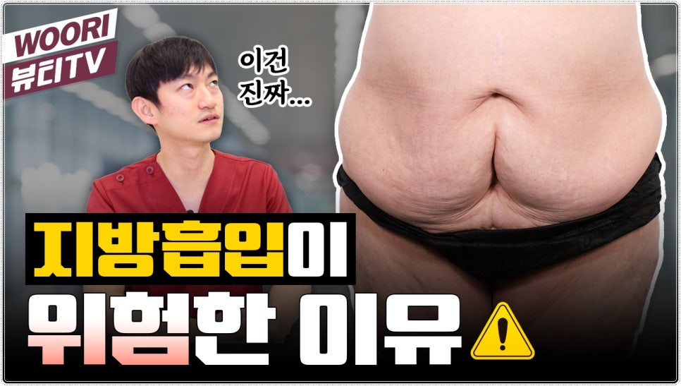 복부지방흡입 부작용 이렇게 관련 이미지 1