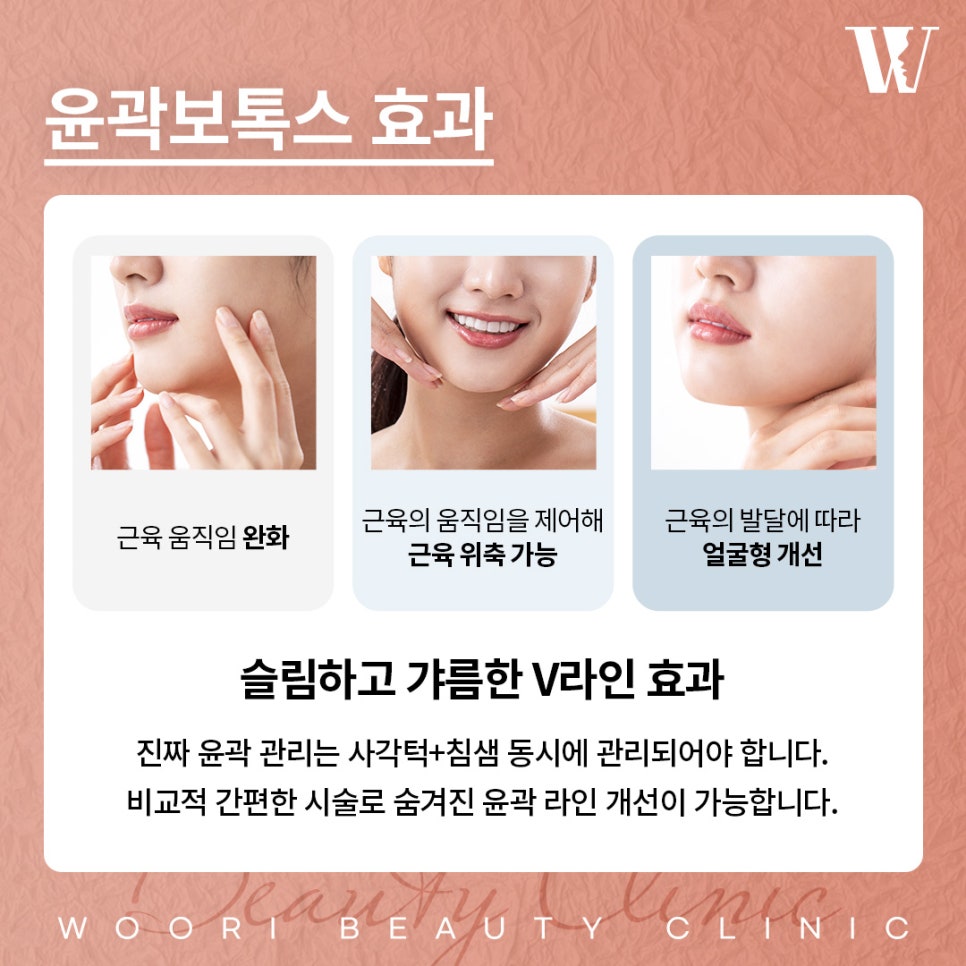 Creating a Soft Facial Contour with Contour Botox image 3