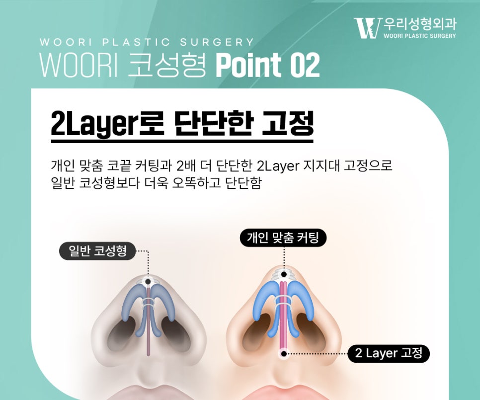 남자코성형 남성 얼굴에 어울리는 코라인을 만들려면 관련 이미지 3