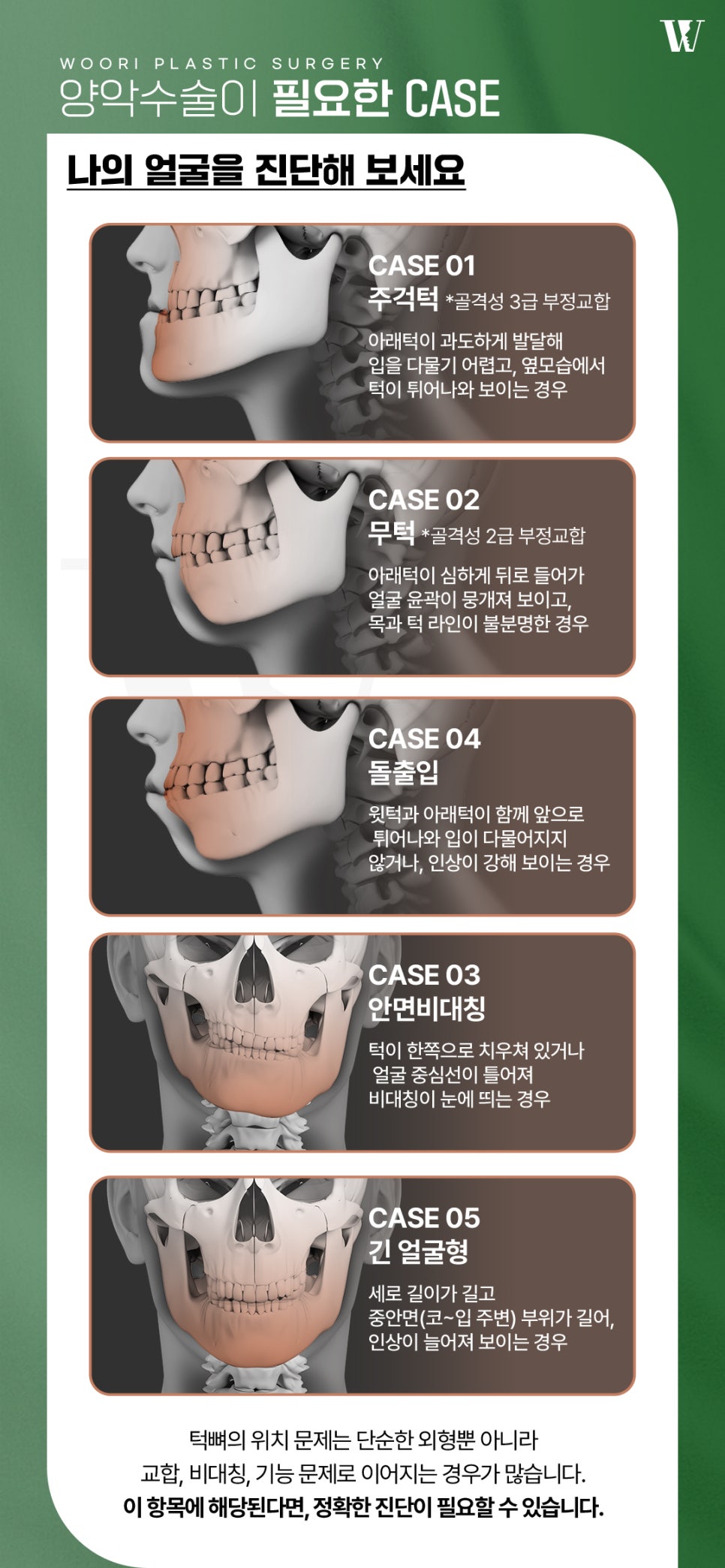양악수술 필요한 케이스 알아보자 관련 이미지 4