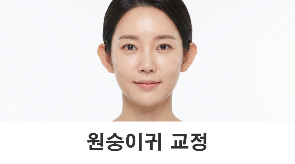 원숭이귀 교정 인상 변화가 크게 느껴지는 이유 관련 이미지 1