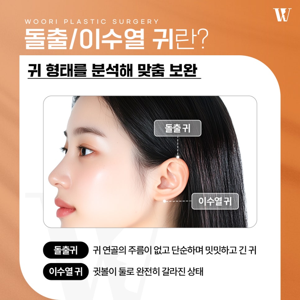 Why Attractive-Looking Ears Affect Facial Impression image 2