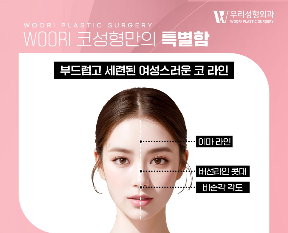 코성형 코끝부터 비순각까지 함께 보는 이유 관련 이미지 4