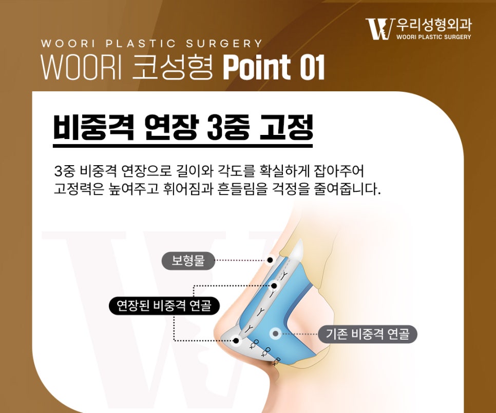 코성형 만족도를 높이는 디자인 포인트 관련 이미지 3