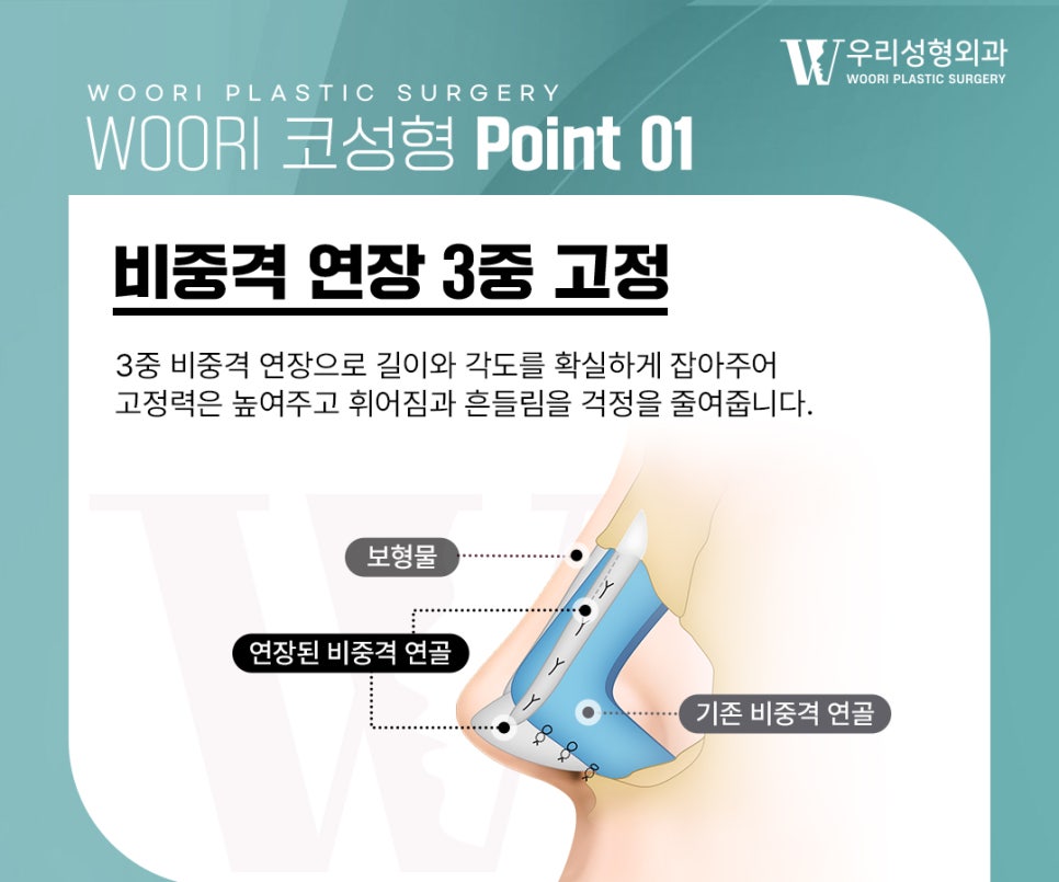매부리코 수술 매부리만 없애는 것보다 중요한 것은? 관련 이미지 3