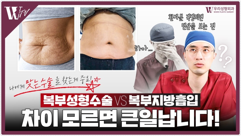 복부거상술 후회하지 않으려면! 관련 이미지 1