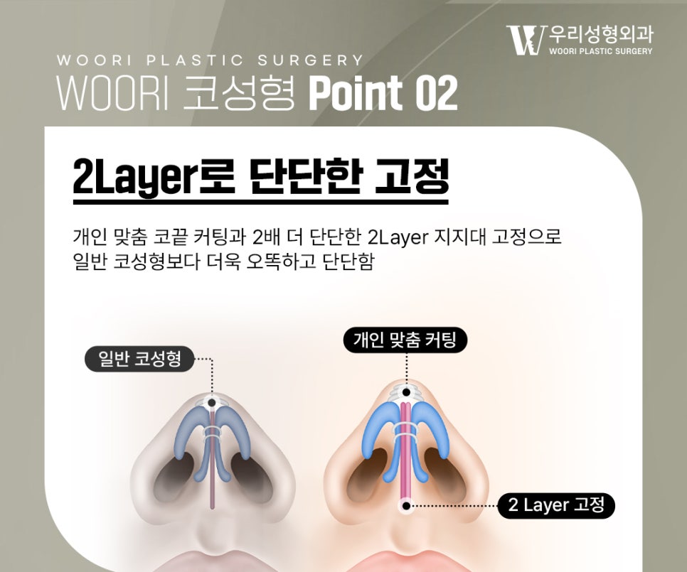 코성형주의사항 수술 계획이 달라지는 이유 관련 이미지 3
