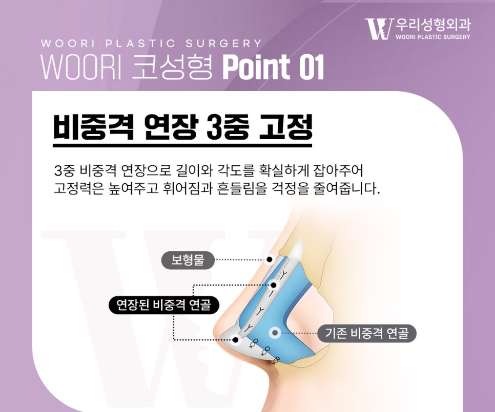 코재수술 시 확인하는 코끝 구조와 비순각 관련 이미지 2