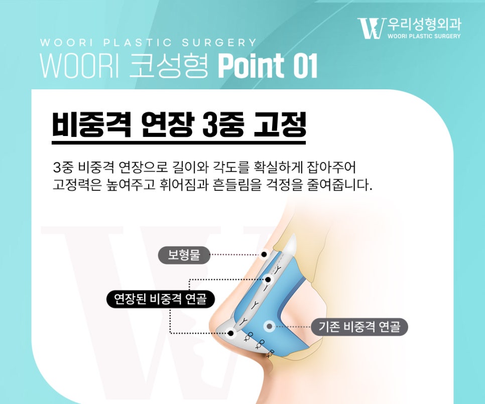 코재수술 흔들림과 휘어짐이 반복되는 이유 관련 이미지 2