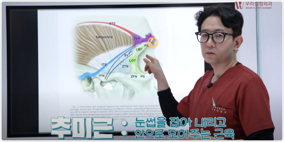 내시경이마거상술 비용 알아보기 전 관련 이미지 3