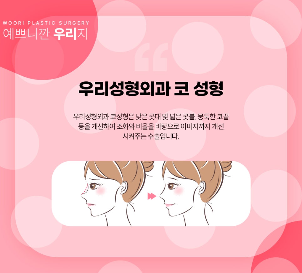 무보형물 코성형 안전한 코수술 후기와 비용은? 관련 이미지 3