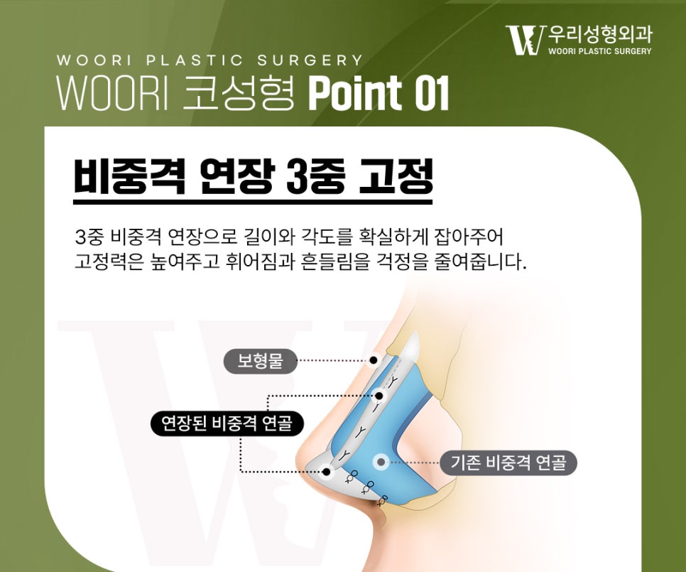 코성형 전 체크해 보세요! 관련 이미지 3