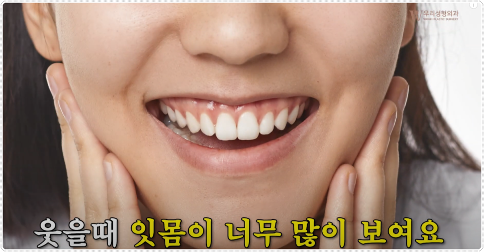 앙약수술과정 함께 살펴봅시다 관련 이미지 4