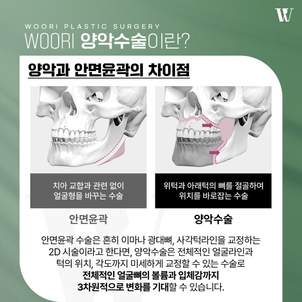 What You Must Check Before Looking Up Orthognathic Surgery Reviews image 2