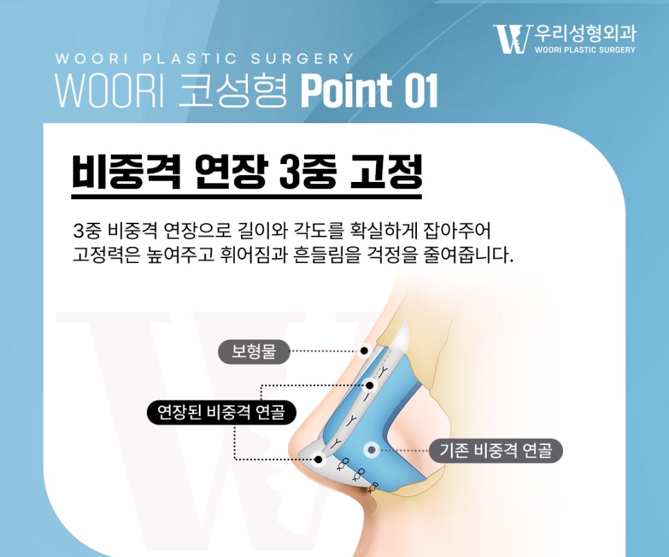 코성형 비중격과 비순각까지 고려해야 하는 이유 관련 이미지 3