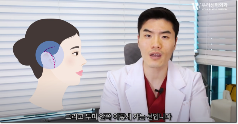 미니거상 효과 좋을까? 관련 이미지 3