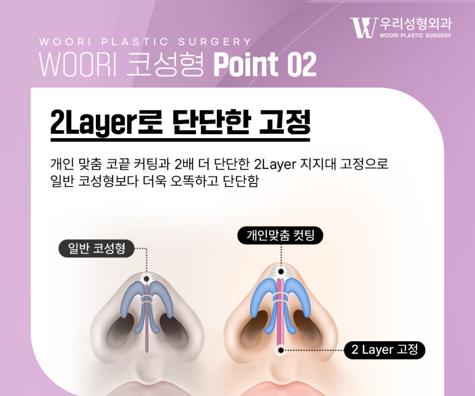 Standards for a Natural-Looking Nose That Harmonizes with the Face image 3
