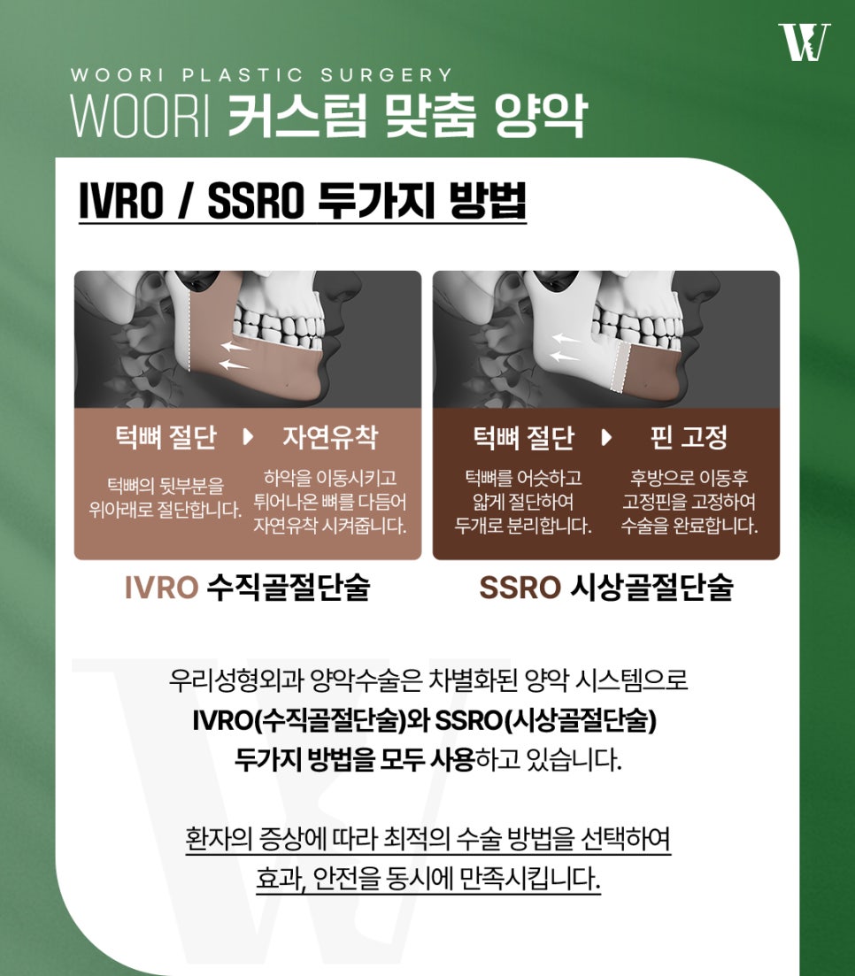 양악수술 필요한 케이스 알아보자 관련 이미지 3