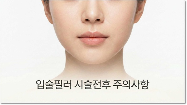 입술필러후기 성공하려면? 관련 이미지 1