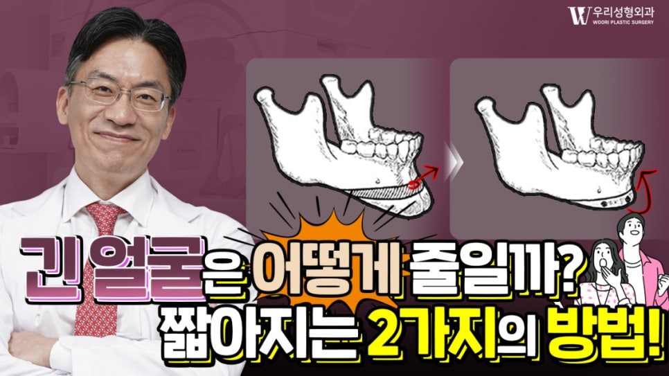 우리성형외과 임평진 원장 긴 얼굴 어떻게 줄일까?! 얼굴 짧아지는 2가지 방법! 관련 이미지 1