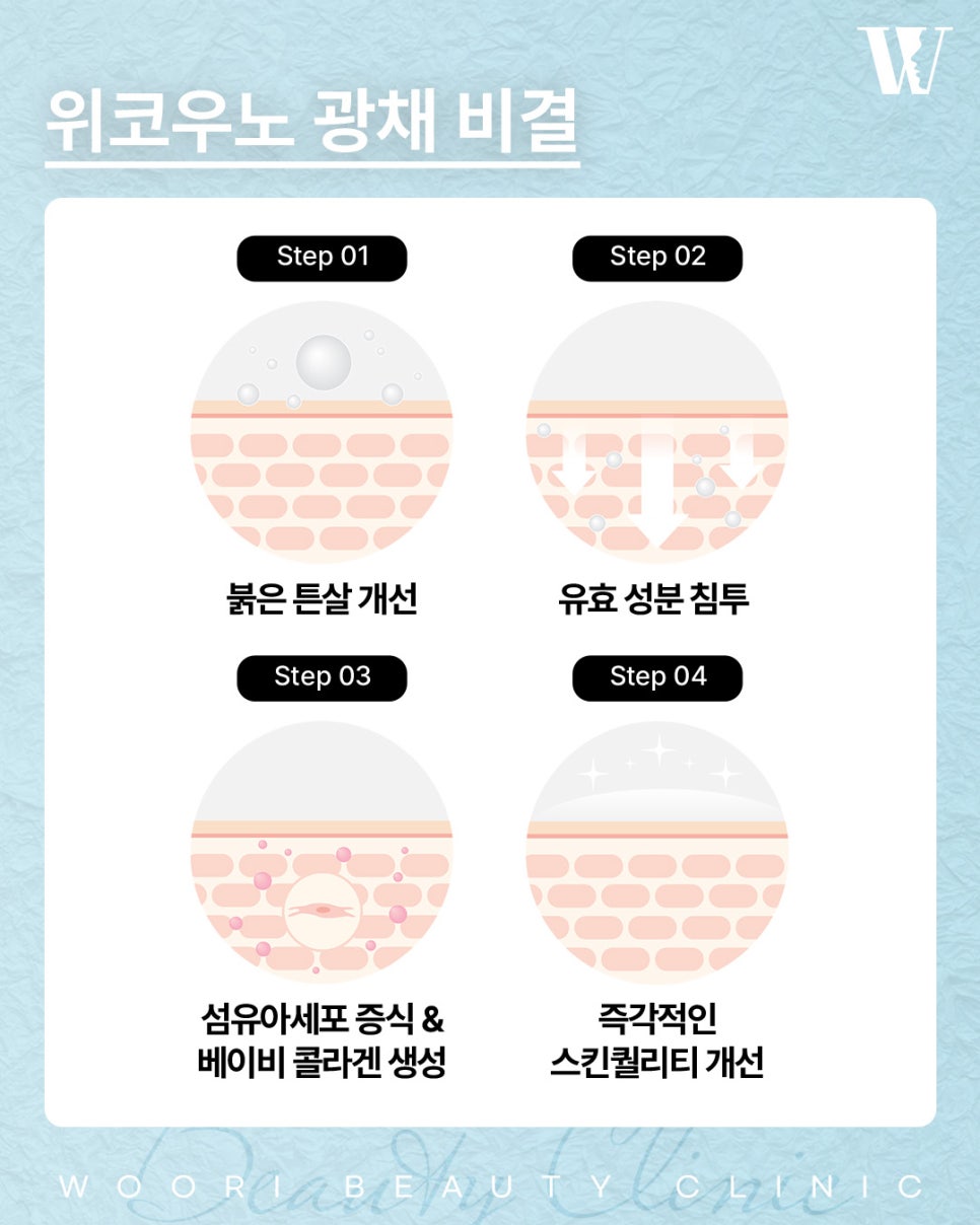 위코우노 바르는 스킨부스터로 관리하기 관련 이미지 4