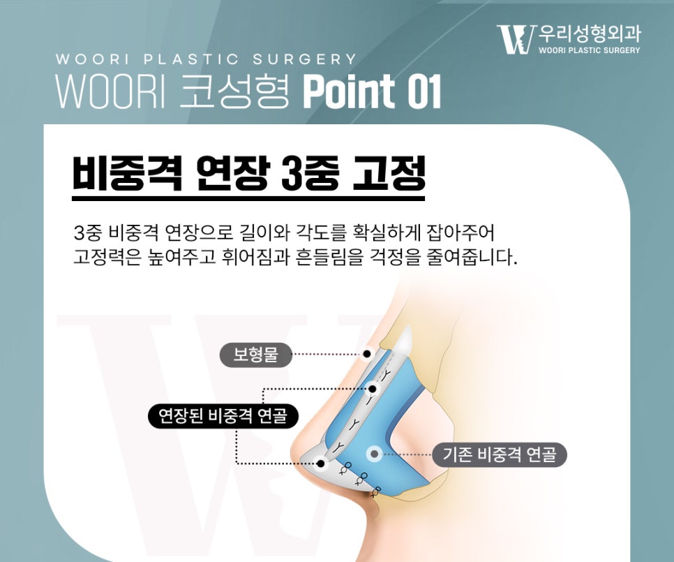 남자코성형 자연스러운 직선코 만드는 방법 관련 이미지 2