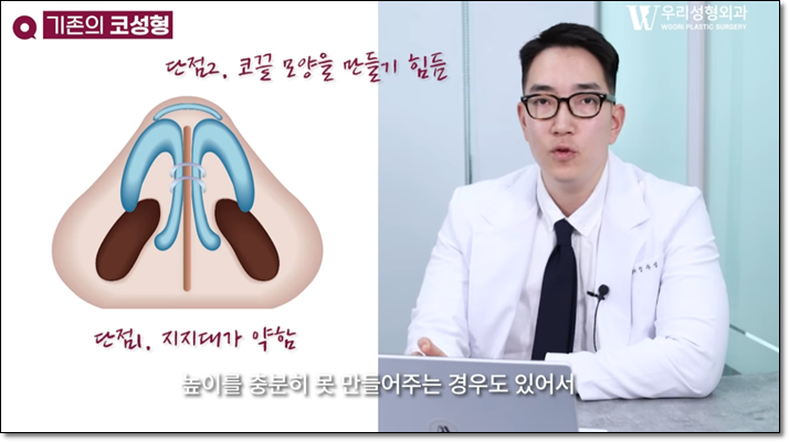 코성형외과 차이 비교해보기 관련 이미지 3