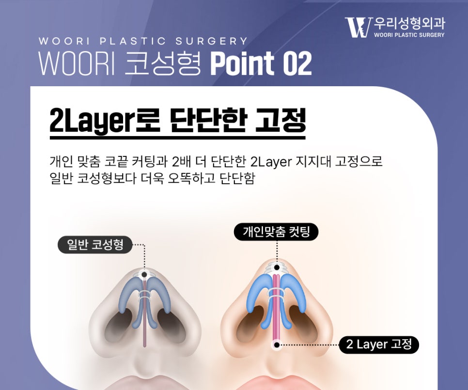 복코성형 코끝이 뭉툭해 보이는 이유는? 관련 이미지 4