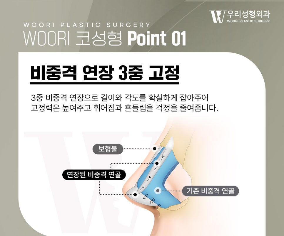 코성형주의사항 수술 계획이 달라지는 이유 관련 이미지 2