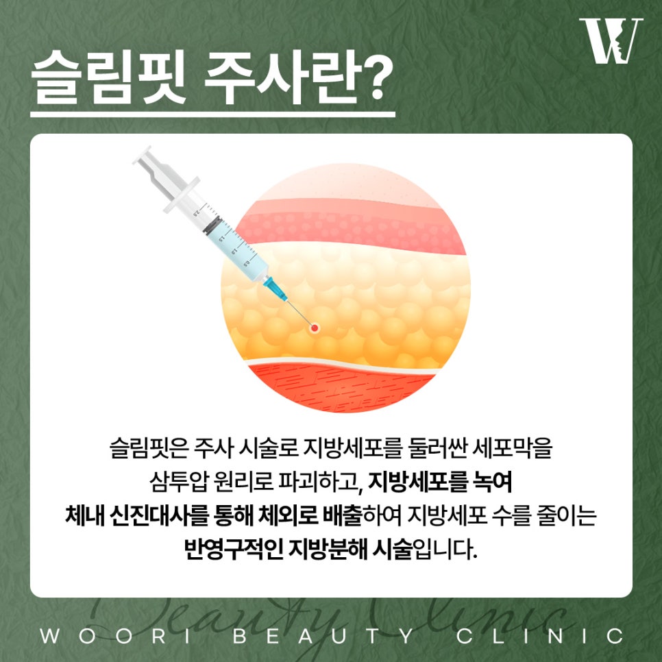 Natural Contouring with a Facial Fat-Dissolving Injection image 2