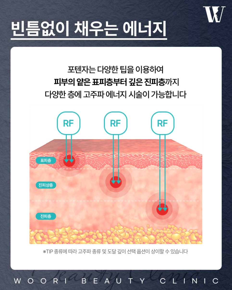 모공포텐자 이런 피부라면 효과를 기대할 수 있습니다 관련 이미지 4