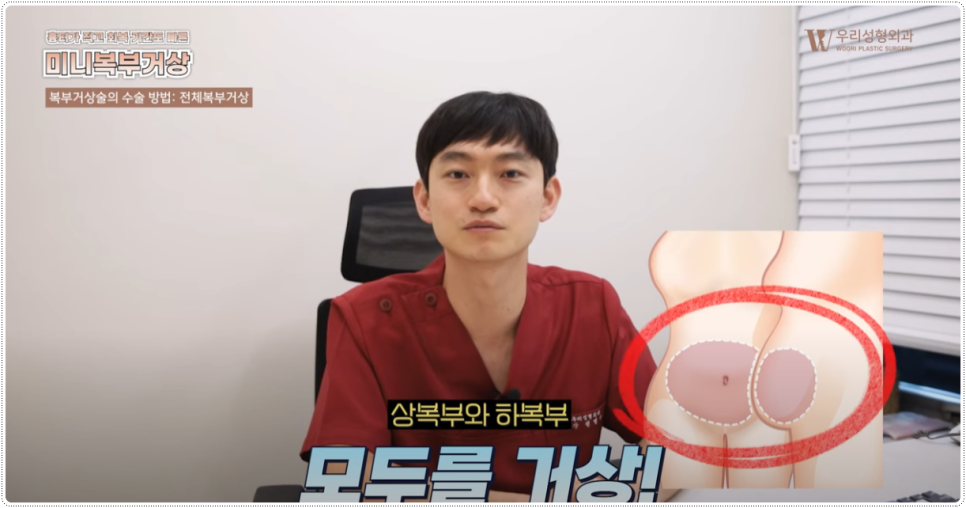 복부거상술 상담 전 체크 사항 관련 이미지 4